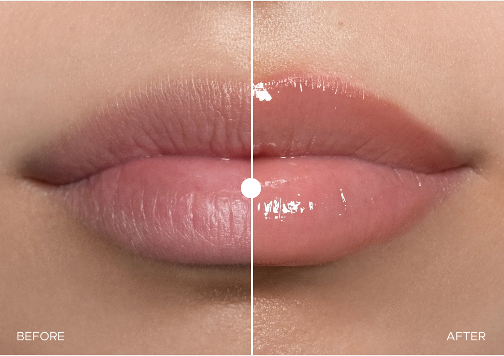 Anfisa: ÂN-GLOSS Ceramide Lip Treatment: Original