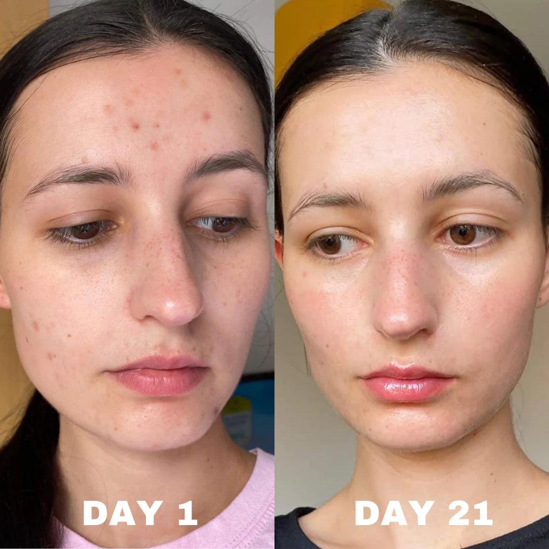 Deviant Skincare: Pigmentation Corrector Serum - Meredith Lane Aesthetics