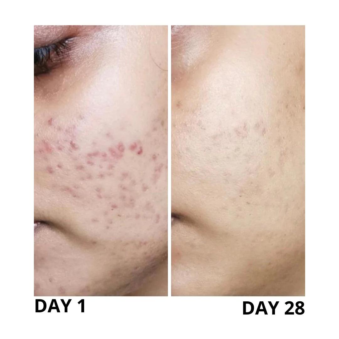 Deviant Skincare: Pigmentation Corrector Serum - Meredith Lane Aesthetics